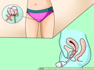 vaginal infection