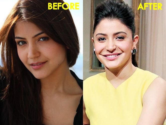 8 Bollywood Actresses Who Spoiled Their Looks After Plastic Surgery See Photos