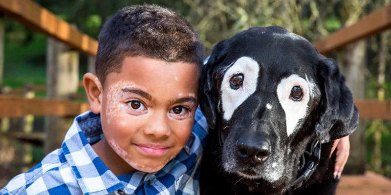 Arkansas Boy Became Best Friend with a dog who has the same rare skin disease as him